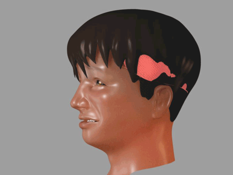 Overpaint1:<br />- Gesicht etwas nach unten geschoben<br />- das Volumen zwischen auge und nasenflügel war zu dick<br />- Mundwinkel-falte entfernt, damit er jünger aussieht<br />- Kinn-Linie klarer definiert<br />- Schädel vergrößert<br />- Ohren verkleinert, damit er jünger aussieht